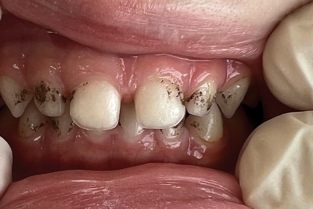 Before treatment