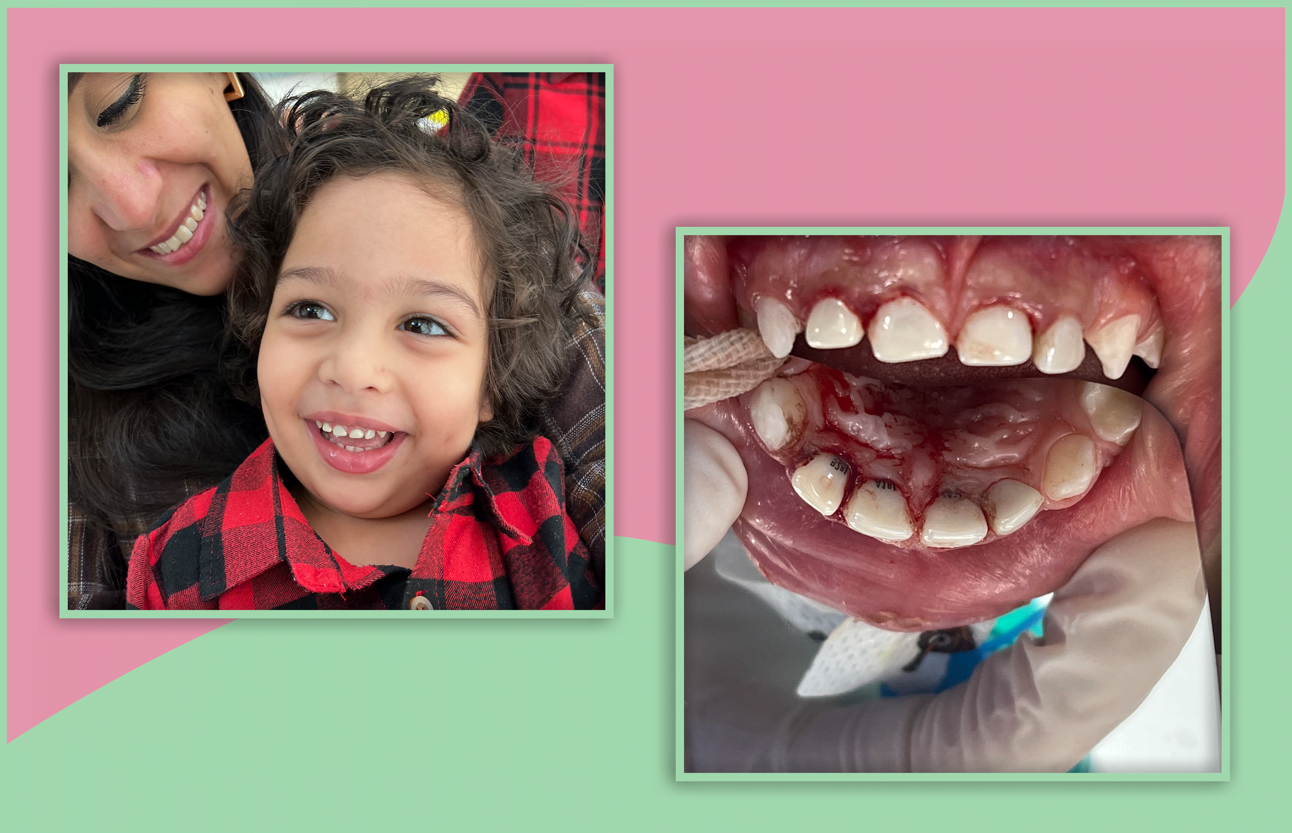 After treatment