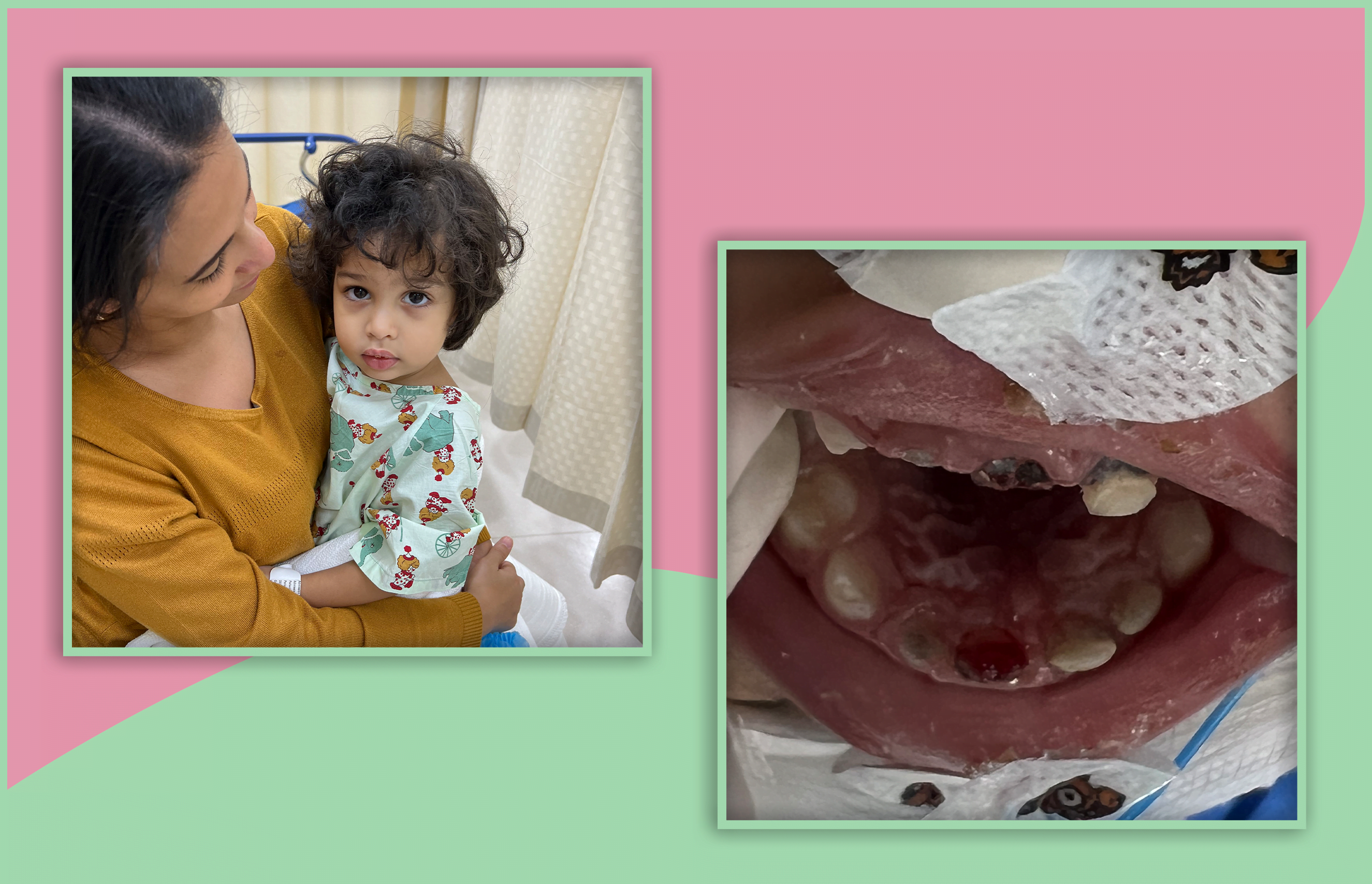 Before treatment