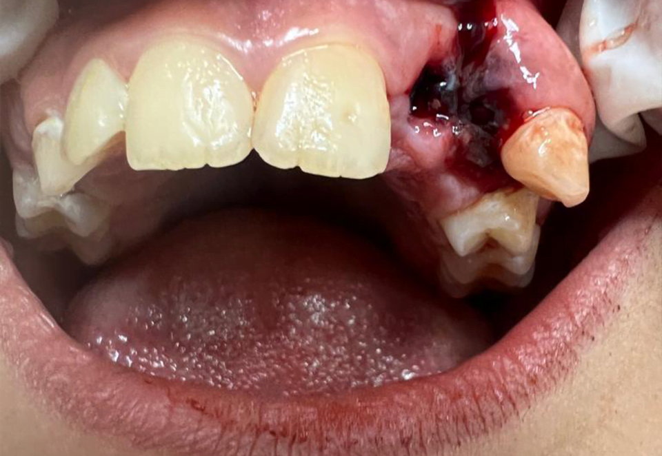Before treatment