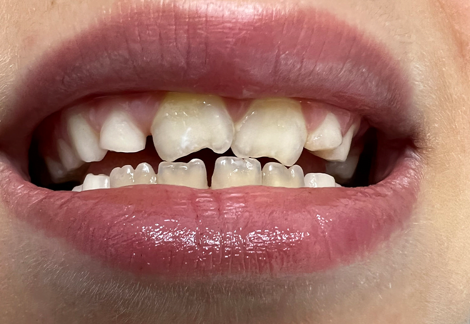 Before treatment